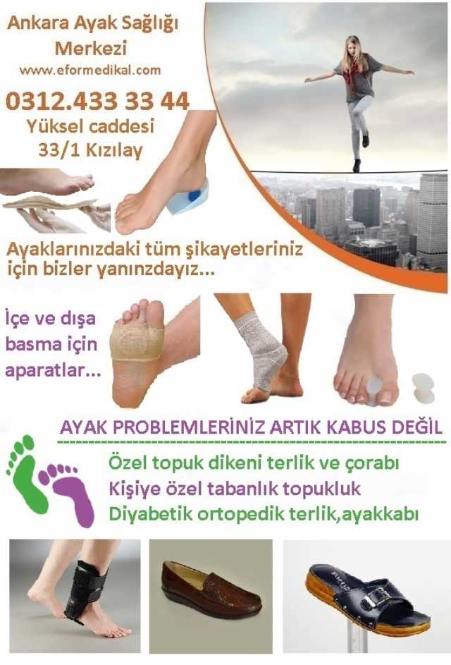 Ayak Sağlığı Ürünleri Ankara Satış Merkezi